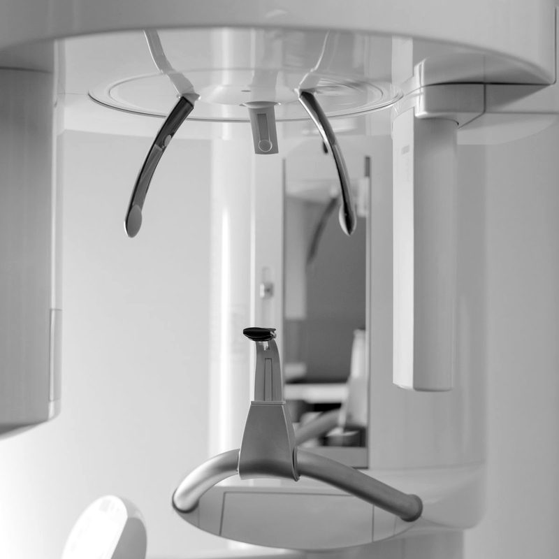 Digital X-ray equipment