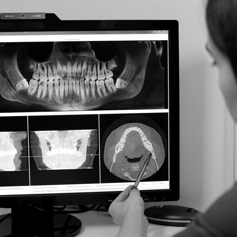 Dentist reviewing an X-ray