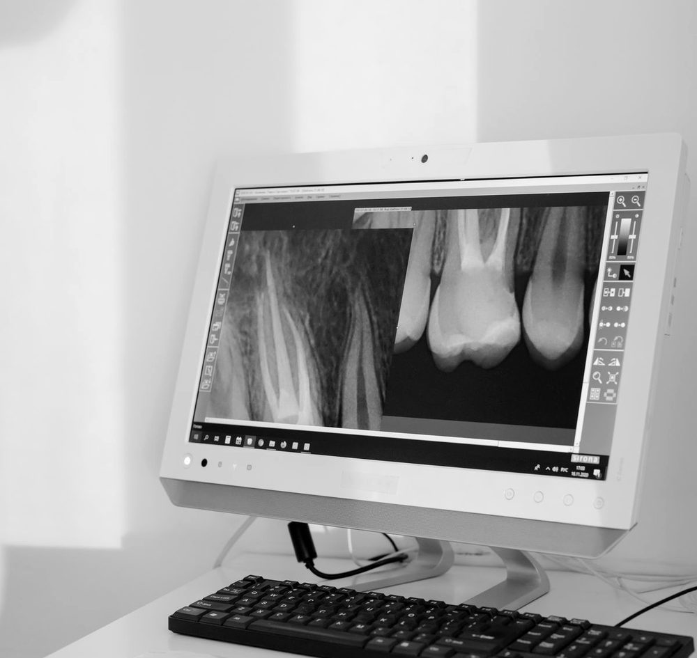 Dental X-ray on a monitor
